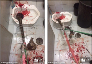 OMG!Snake bits man on his penis while sitting on toilet sink(PHOTO)